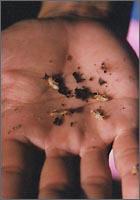 Termites on my hand